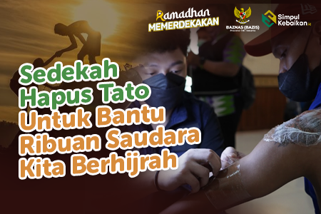 Sedekah Hapus Tato Gratis Untuk Bantu Saudara Kita Berhijrah