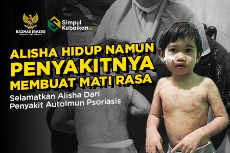 Berjuang dari Autoimun dan Gizi Kurang, Bantu Selamatkan Alisha