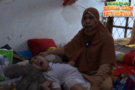 Tahan Kesakitan, Andrian Berjuang Lawan Hidrosefalus!